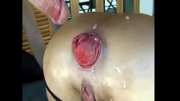 Porn – Bizarre Milf Moms Hardcore Anal Fisting Prolapse