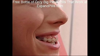 Sandra Skinny Teen Braces Anal Facial Sandra Skinny Teen Braces Anal Facial
